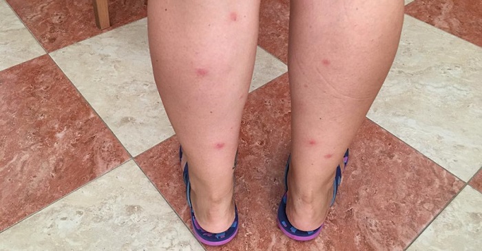 El PSOE denuncia la plaga de pulgas que sufren los vecinos del barrio de San Miguel de Almuñécar.jpg